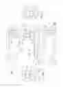 Fig. 05 - Ocular system with anchoring implant and therapeutic agent