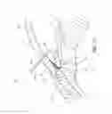 Fig. 13 - Ocular system with anchoring implant and therapeutic agent