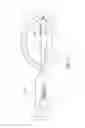 Fig. 15 - Ocular system with anchoring implant and therapeutic agent