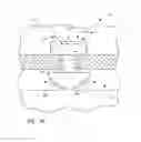 Fig. 23 - Ocular system with anchoring implant and therapeutic agent