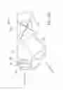 Fig. 40 - Ocular system with anchoring implant and therapeutic agent
