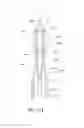 Fig. 41 - Ocular system with anchoring implant and therapeutic agent