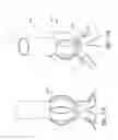 Fig. 50 - Ocular system with anchoring implant and therapeutic agent