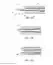 Fig. 59 - Ocular system with anchoring implant and therapeutic agent