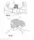 Fig. 06 - WOUND CARE DEVICE