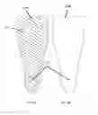Fig. 07 - Therapeutic compression garment and method of applying the garment