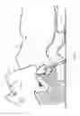 Fig. 02 - Jaw thrust device and method