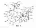 Fig. 04 - Jaw thrust device and method