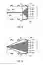 Fig. 06 - Enhanced body bag