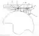 Fig. 01 - Neck exercise and rehabilitation device