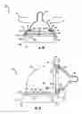 Fig. 04 - Quick-access bottle top for a baby bottle
