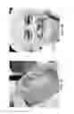 Fig. 04 - Systems and methods for skin rejuvenation