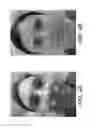 Fig. 05 - Systems and methods for skin rejuvenation