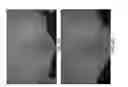 Fig. 07 - Systems and methods for skin rejuvenation