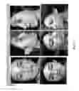 Fig. 08 - Systems and methods for skin rejuvenation