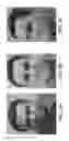 Fig. 09 - Systems and methods for skin rejuvenation
