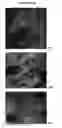 Fig. 11 - Methods of regulating skin health and appearance with a combination of flavonoid and vitamin B