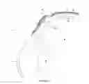 Fig. 04 - Posterior segment drug delivery