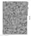 Fig. 59 - Posterior segment drug delivery