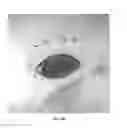 Fig. 63 - Posterior segment drug delivery