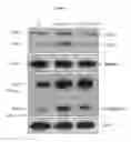 Fig. 12 - Composition comprising ASM inhibitor as active ingredient for preventing or treating degenerative neurological disorders