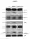 Fig. 14 - Composition comprising ASM inhibitor as active ingredient for preventing or treating degenerative neurological disorders