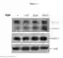 Fig. 18 - Composition comprising ASM inhibitor as active ingredient for preventing or treating degenerative neurological disorders