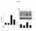 Fig. 20 - Composition comprising ASM inhibitor as active ingredient for preventing or treating degenerative neurological disorders