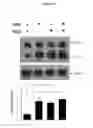 Fig. 21 - Composition comprising ASM inhibitor as active ingredient for preventing or treating degenerative neurological disorders