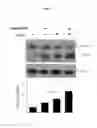Fig. 22 - Composition comprising ASM inhibitor as active ingredient for preventing or treating degenerative neurological disorders