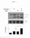 Fig. 23 - Composition comprising ASM inhibitor as active ingredient for preventing or treating degenerative neurological disorders