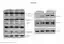 Fig. 31 - Composition comprising ASM inhibitor as active ingredient for preventing or treating degenerative neurological disorders