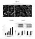 Fig. 05 - Composition including rapamycin as active ingredient for preventing or treating hearing loss