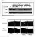Fig. 02 - Pharmaceutical composition comprising N1-cyclic amine-N5-substituted biguanide derivatives as an ingredient for preventing or treating fibrosis