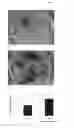 Fig. 06 - Agent for promoting corneal endothelial cell adhesion