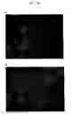 Fig. 09 - Agent for promoting corneal endothelial cell adhesion