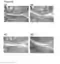 Fig. 05 - COMPOSITIONS FOR USE IN CARTILAGE BREAKDOWN