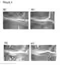 Fig. 06 - COMPOSITIONS FOR USE IN CARTILAGE BREAKDOWN