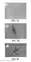 Fig. 03 - Compositions comprising nanoparticles and apoptotic agents and methods of use