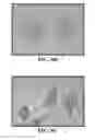 Fig. 10 - Compositions comprising nanoparticles and apoptotic agents and methods of use