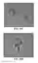 Fig. 13 - Compositions comprising nanoparticles and apoptotic agents and methods of use