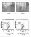 Fig. 02 - ORGANOIDS COMPRISING ISOLATED RENAL CELLS AND USE THEREOF