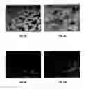 Fig. 08 - ORGANOIDS COMPRISING ISOLATED RENAL CELLS AND USE THEREOF