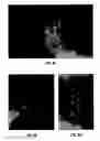 Fig. 10 - ORGANOIDS COMPRISING ISOLATED RENAL CELLS AND USE THEREOF