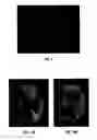 Fig. 11 - ORGANOIDS COMPRISING ISOLATED RENAL CELLS AND USE THEREOF
