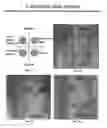 Fig. 08 - Method and Composition for Hypothermic Storage of Placental Tissue