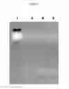 Fig. 04 - Method for therapeutic replenishment and enrichment of ocular surface lubrication