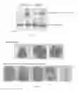 Fig. 18 - Compounds and methods of modulating angiogenesis