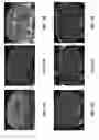 Fig. 18 - MRI imaging of amyloid plaque using liposomes