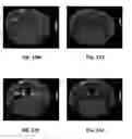 Fig. 24 - MRI imaging of amyloid plaque using liposomes